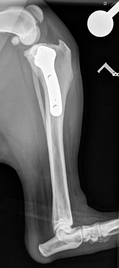 TPLO